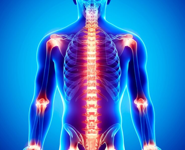 Joint and Pain Management